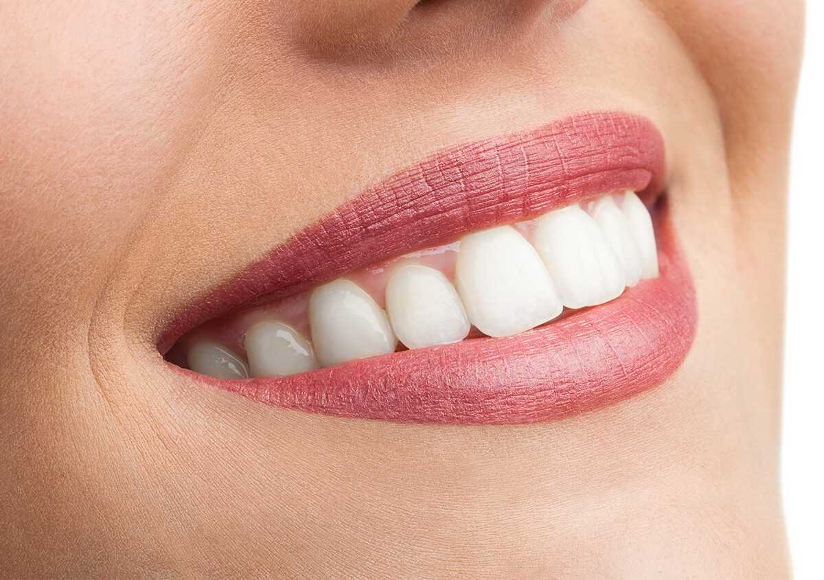 Professional Teeth Whitening Dentist in New York Area